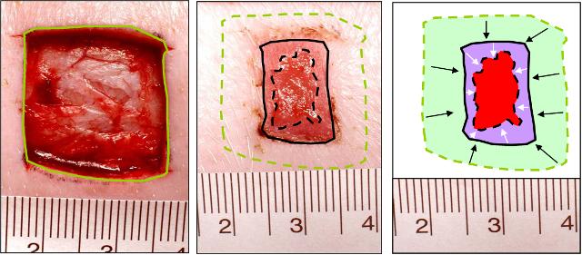 Wound Closure, Re-epithelialisation, Wound Contraction, Measurement