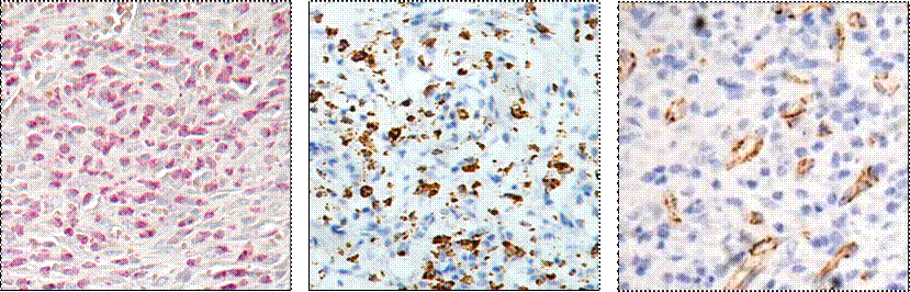 Wound Neutrophils - Leder Stain, Wound Macrophages - ED1 immunohistochemistry, Wound angiogenesis - CD31 immunohistochemistry, Wound Histology, Wound Healing Research